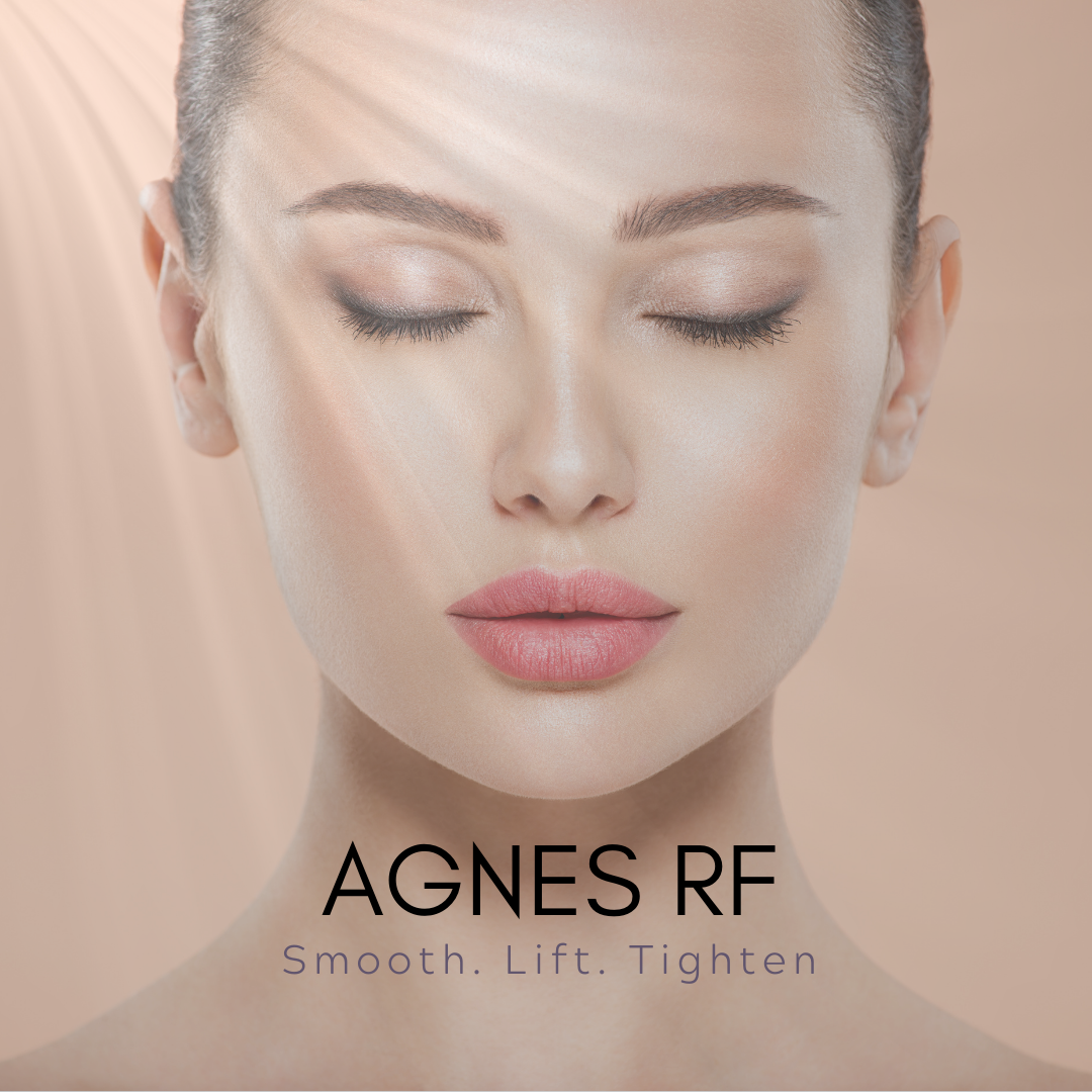 Agnes Rf Microneedling Technology Apex Medical Spa